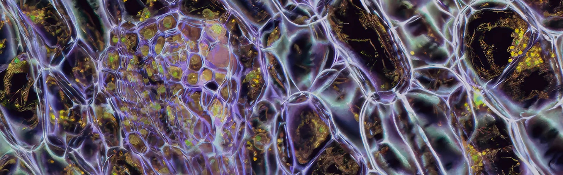 The image shows a detailed microscopic view of plant cells, featuring a rich mix of purples and hints of gold. The intricate cell walls are visible, creating a web-like pattern, with some cells showing a honeycomb structure.